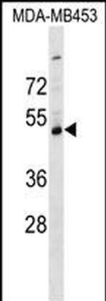 SERPINI2 Polyclonal Antibody