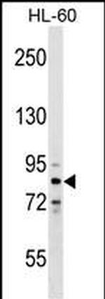 ZNF224 Polyclonal Antibody