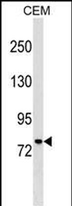 MUM1 Polyclonal Antibody