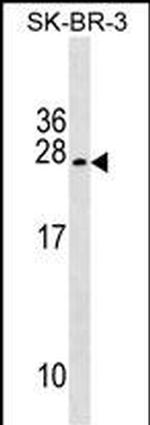 TUSC5 Polyclonal Antibody