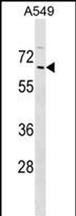 ZNF675 Polyclonal Antibody