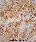 LC3B Polyclonal Antibody
