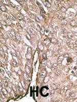 LC3B Antibody in Immunohistochemistry (Paraffin) (IHC (P))