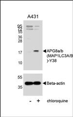LC3B Antibody in Western Blot (WB)