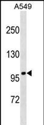 FANCB Antibody in Western Blot (WB)