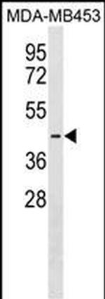 Pejvakin Polyclonal Antibody