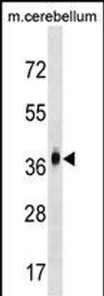 MMD2 Polyclonal Antibody
