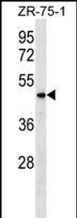 VN1R5 Polyclonal Antibody
