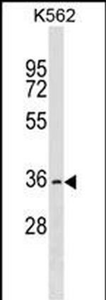 OR2AG2 Polyclonal Antibody