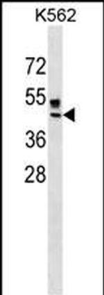 ZNRF4 Polyclonal Antibody