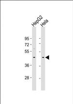 GIPC3 Polyclonal Antibody