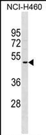OR2A5 Polyclonal Antibody