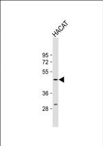 PGRP-1b Polyclonal Antibody