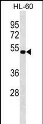 ASAHL Polyclonal Antibody