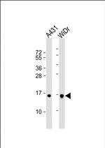 Histone H2B Polyclonal Antibody