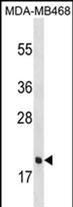 PGLYRP1 Polyclonal Antibody