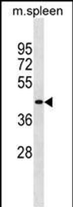 SLC10A2 Polyclonal Antibody