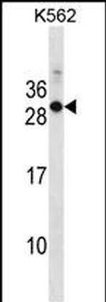 RAB17 Polyclonal Antibody