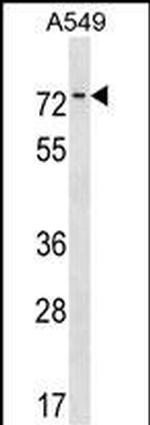 HKR1 Antibody in Western Blot (WB)