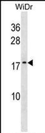 ATP5L2 Polyclonal Antibody