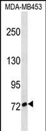 CUX1 Polyclonal Antibody