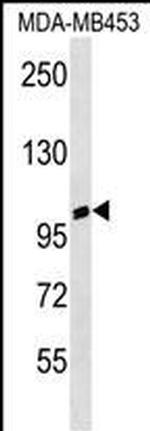 A20A3 Polyclonal Antibody