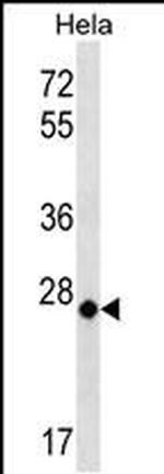 COX3 Polyclonal Antibody