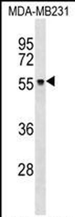 ZNF737 Polyclonal Antibody