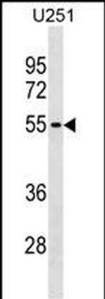 KLHDC7B Polyclonal Antibody