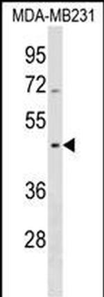 SEPT12 Antibody in Western Blot (WB)
