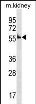Cyclin A1 Polyclonal Antibody