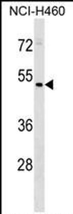 HEPACAM2 Polyclonal Antibody