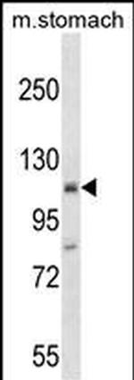 ST18 Polyclonal Antibody