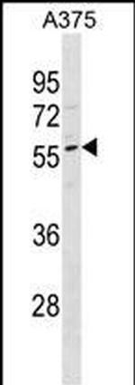 DPCR1 Polyclonal Antibody
