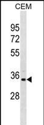 PRPS1L1 Polyclonal Antibody
