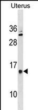 GALNTL5 Polyclonal Antibody
