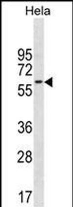 PAF49 Polyclonal Antibody