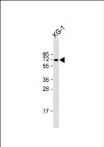 ZNF93 Polyclonal Antibody