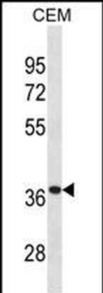 alpha TTP Polyclonal Antibody