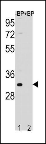 FAM26F Antibody in Western Blot (WB)