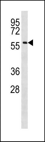 CCDC155 Polyclonal Antibody
