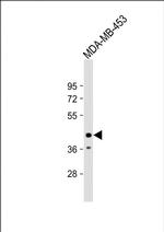 LMAN2L Polyclonal Antibody