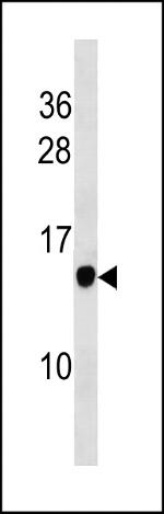 POMP Polyclonal Antibody