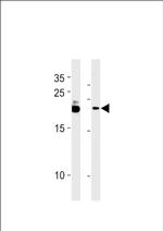 C13orf30 Polyclonal Antibody