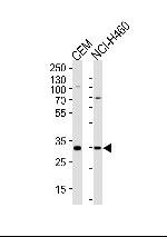 Macro H2A.2 Polyclonal Antibody