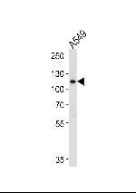 BICC1 Polyclonal Antibody