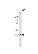 CD16 Antibody in Western Blot (WB)