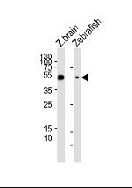 GFAP Antibody in Western Blot (WB)