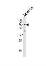 L-Plastin Antibody in Western Blot (WB)