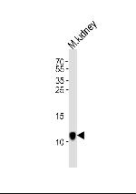 C1orf151 Polyclonal Antibody